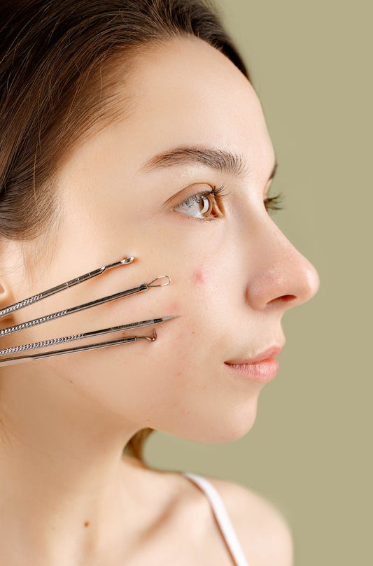 MỤN ĐẦU ĐEN Ở TAI, XỬ LÝ RA SAO?